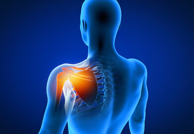 shoulder-arthritis